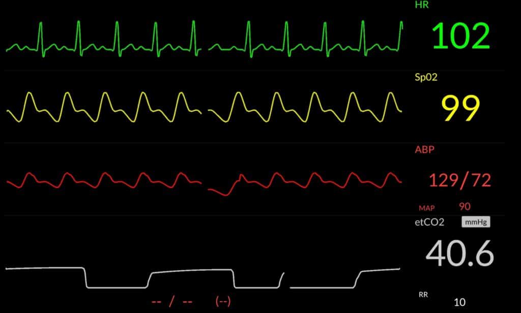 Anaesthesia Image